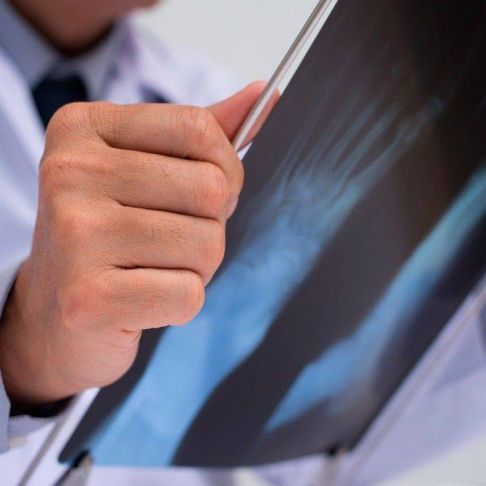 Consulta Traumatología y  radiología simple.