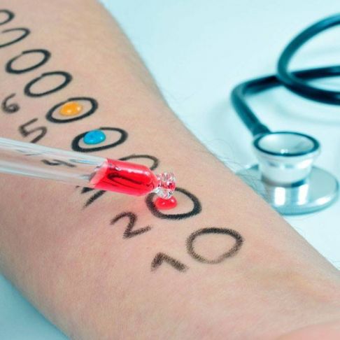 Pruebas cutáneas para alergias
