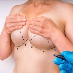 Consulta Cirugía Estética