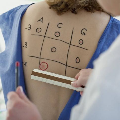 Pruebas cutáneas para alergias