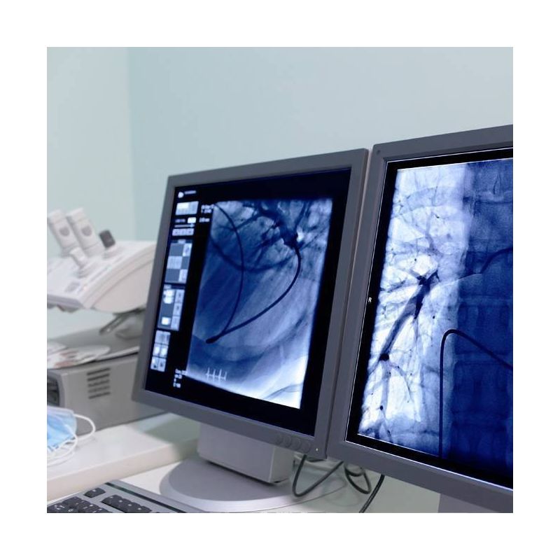 Consulta de Cardiología y Holter ECG
