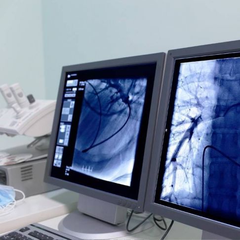 Holter EGC