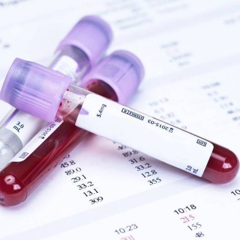 Analitica completa ETS (en sangre)