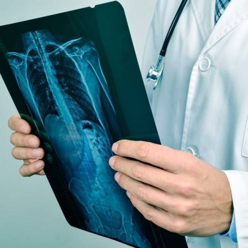 Consulta Cardiología y Rx Tórax