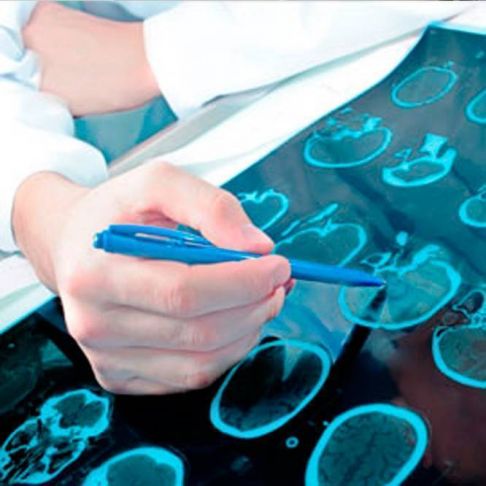 Potenciales Evocados