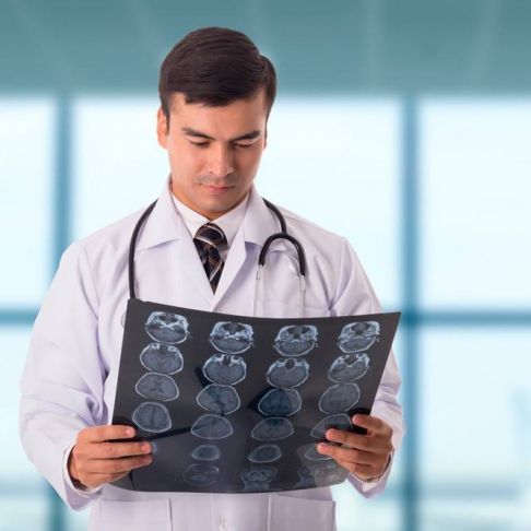 Electroencefalograma