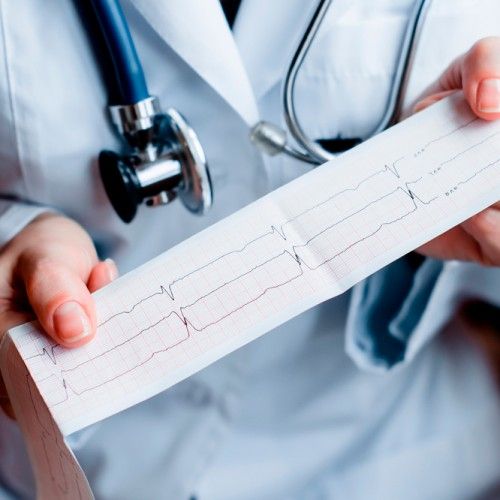 Consulta Cardiología y Electrocardiograma en Yecla